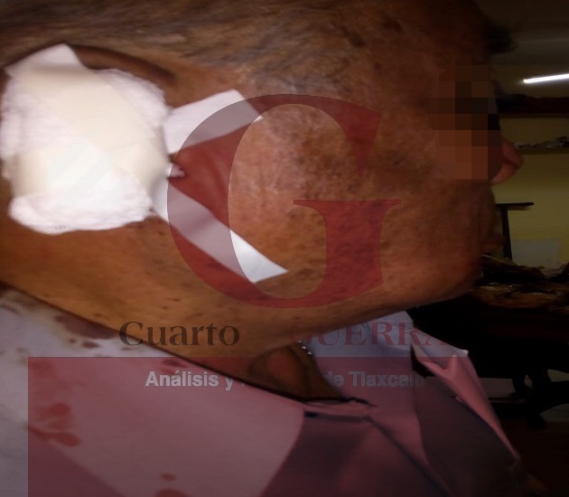 Sufre agresión el periodista Edgar Juárez
